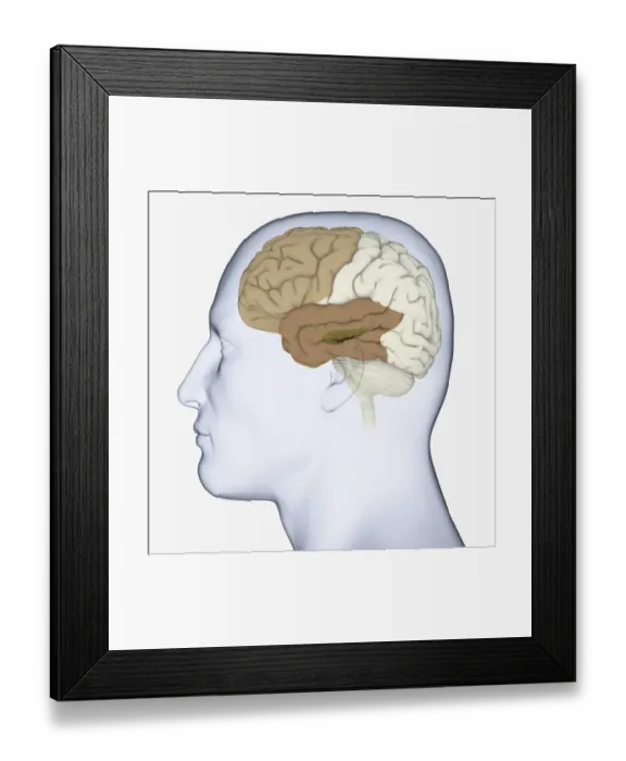 Framed Print : Digital illustration of head in profile showing brain with hippocampus, frontal and temporal lobes highlighted