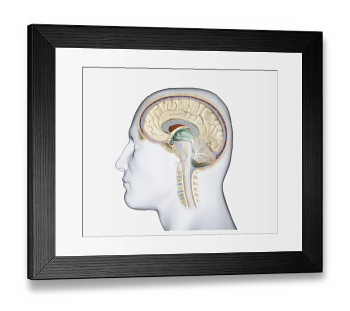Framed Print : Digital illustration of head in profile showing pituitary tumour in human brain Framed Print : Digital illustration of head in profile showing pituitary tumour in human brain