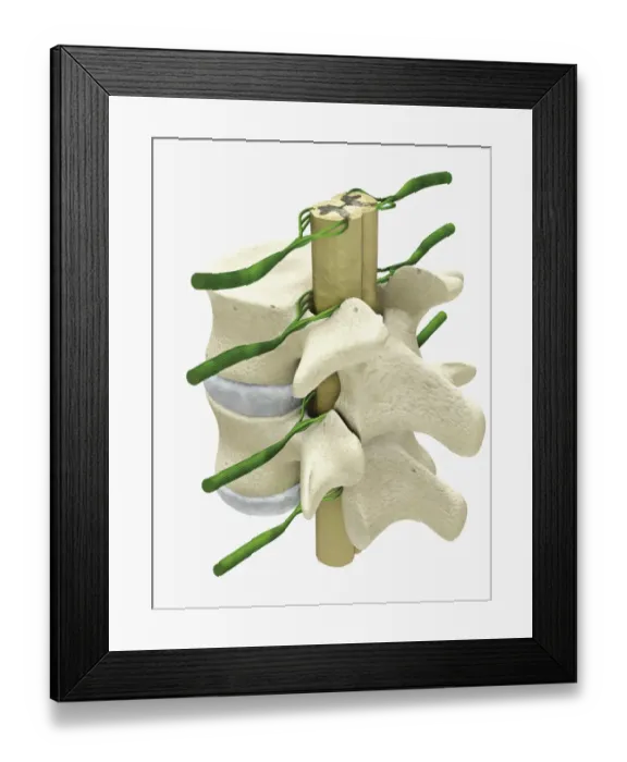 Framed Print : Cross section digital illustration of spinal cord and nerves surrounded by vertebra Framed Print : Cross section digital illustration of spinal cord and nerves surrounded by vertebra