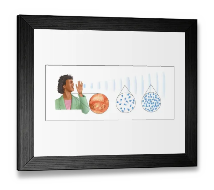 Framed Print : Illustrations of woman shouting showing sound waves and insets of vocal cords, rarefaction and compr Framed Print : Illustrations of woman shouting showing sound waves and insets of vocal cords, rarefaction and compr