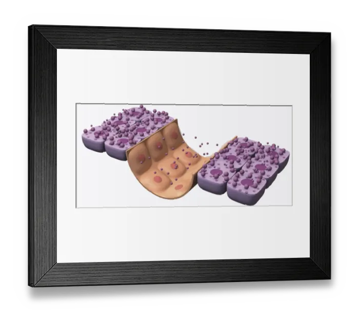 Framed Print : Illustration of low blood glucose response Framed Print : Illustration of low blood glucose response
