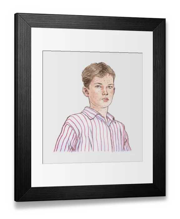 Framed Print : Illustration of teenage boy with chickenpox Framed Print : Illustration of teenage boy with chickenpox