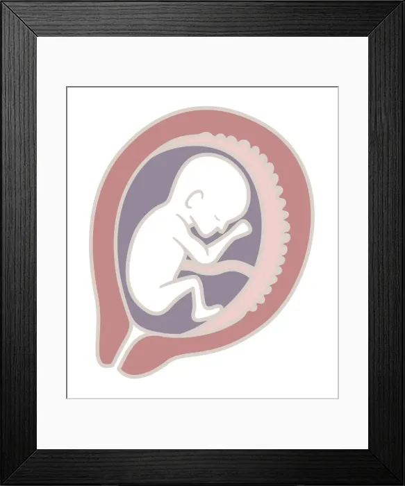 Framed Print : Digital illustration of 16 week old human foetus in uterus Framed Print : Digital illustration of 16 week old human foetus in uterus