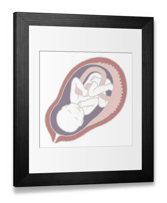Framed Print : Digital illustration of 32 week old human foetus in uterus Framed Print : Digital illustration of 32 week old human foetus in uterus