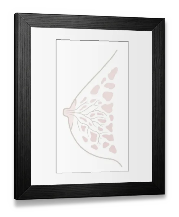 Framed Print : Digital illustration of human breast anatomy, cross section Framed Print : Digital illustration of human breast anatomy, cross section