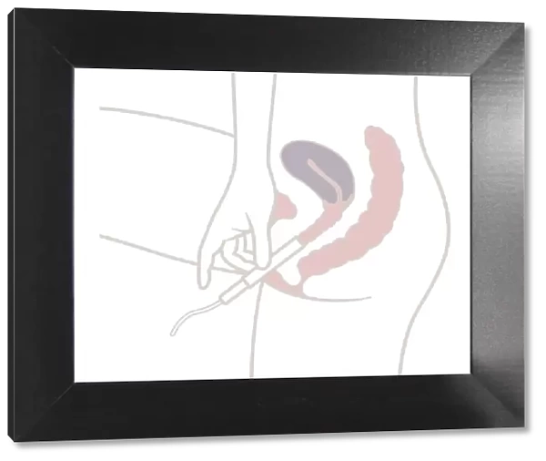 Digital illustration of inserting tampon in vagina