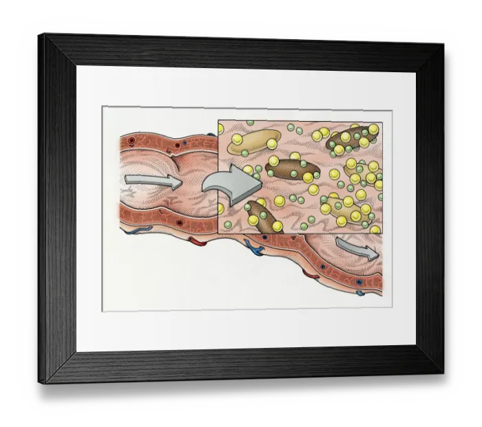 Framed Print : Illustration showing role of fibre in human digestive process Framed Print : Illustration showing role of fibre in human digestive process