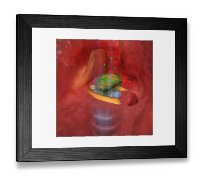 Framed Print : Digital cross section illustration of food entering the trachea the wrong way