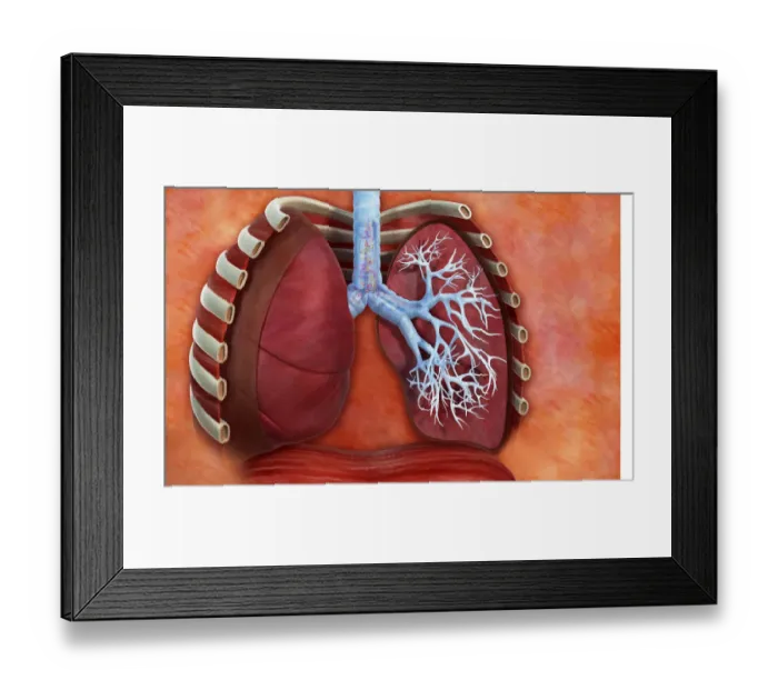 Framed Print : Digital cross section illustration of human lung with pollen allergens in trachea and bronchioles ca Framed Print : Digital cross section illustration of human lung with pollen allergens in trachea and bronchioles ca