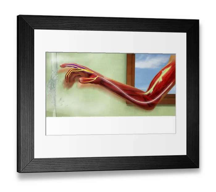 Framed Print : Digital illustration showing sensory neurons sending message to nerves in human arm after scalding b Framed Print : Digital illustration showing sensory neurons sending message to nerves in human arm after scalding b