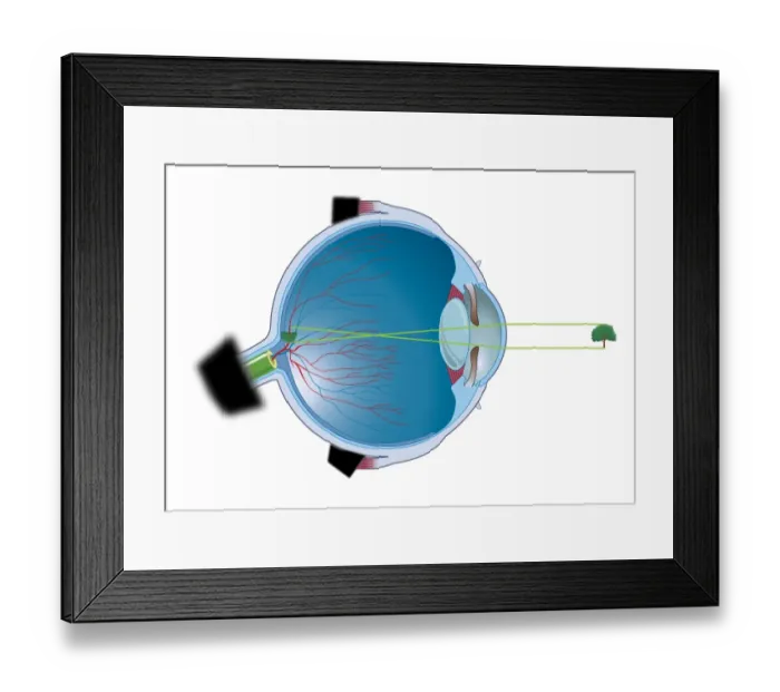 Framed Print : Digital illustration of vertebrate eye using lens to focus light and form and image Framed Print : Digital illustration of vertebrate eye using lens to focus light and form and image
