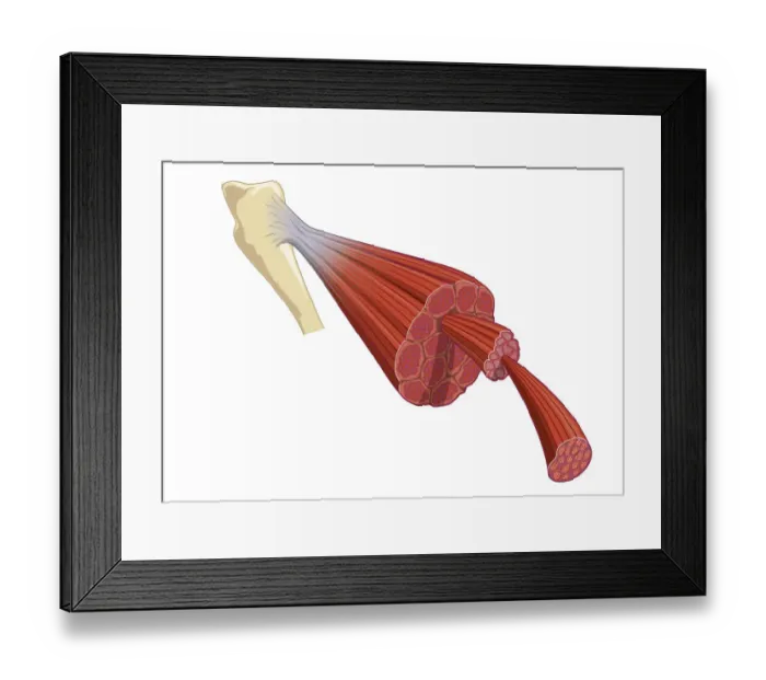 Framed Print : Digital illustration of vertebrate muscle attached to skeleton, consisting of bundles of muscle fibres composed of thousands of thinner muscle fibrils