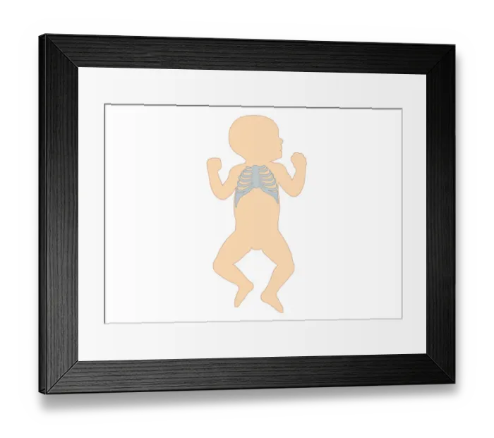 Framed Print : Digital illustration of newborn baby showing rib cage Framed Print : Digital illustration of newborn baby showing rib cage