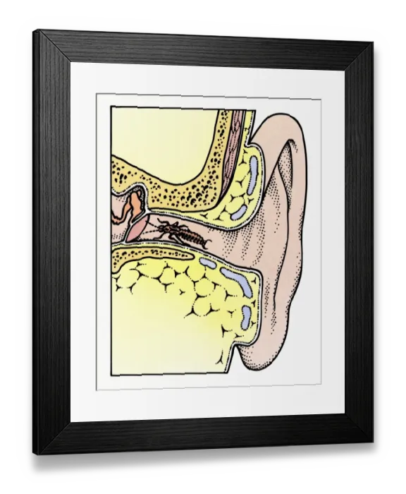 Framed Print : Cross section illustration of Common Earwig (Forficula auricularia) in auditory canal of ear, touching tympanic membrane with antennae Framed Print : Cross section illustration of Common Earwig (Forficula auricularia) in auditory canal of ear, touching tympanic membrane with antennae