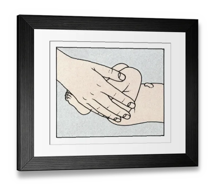 Framed Print : Illustration showing physical examination of babys legs to check alignment immediately after birth Framed Print : Illustration showing physical examination of babys legs to check alignment immediately after birth
