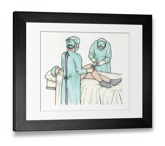 Framed Print : Illustration showing surgeon swabbing and removing object from knee of patient lying on operating table Framed Print : Illustration showing surgeon swabbing and removing object from knee of patient lying on operating table