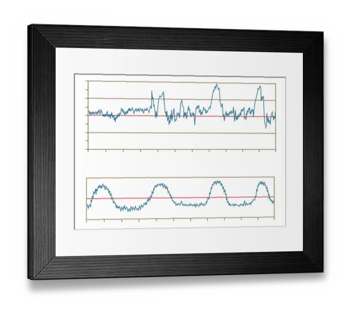 Framed Print : Digital illustration of fetal monitoring graph Framed Print : Digital illustration of fetal monitoring graph