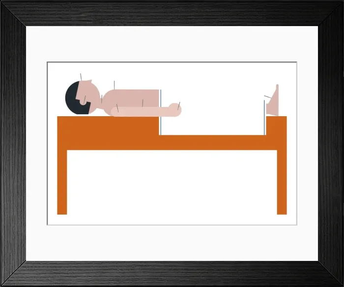 Framed Print : Digital illustration representing man lying on back on acupuncture table Framed Print : Digital illustration representing man lying on back on acupuncture table