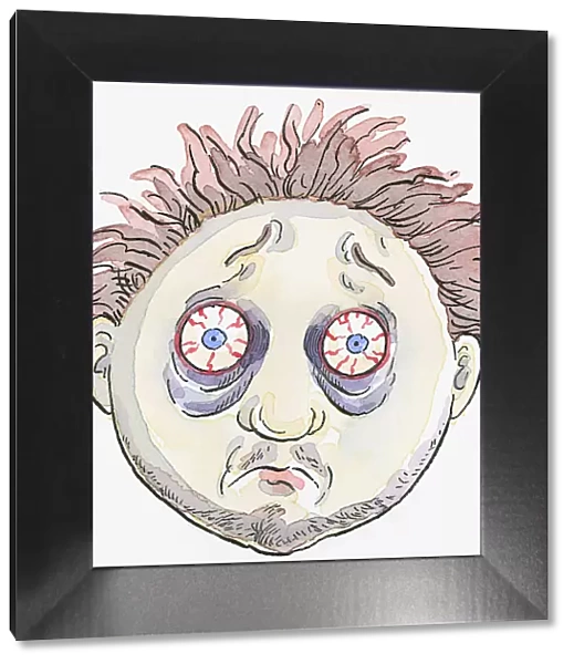 Cartoon of man with messy hair, bags below bloodshot eyes, and stubble on face and chin
