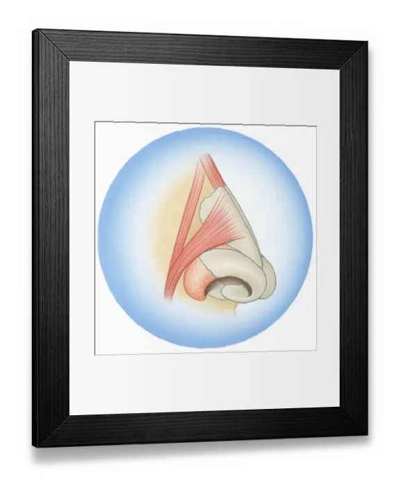 Framed Print : Illustration of septum cartilage inside human nose Framed Print : Illustration of septum cartilage inside human nose