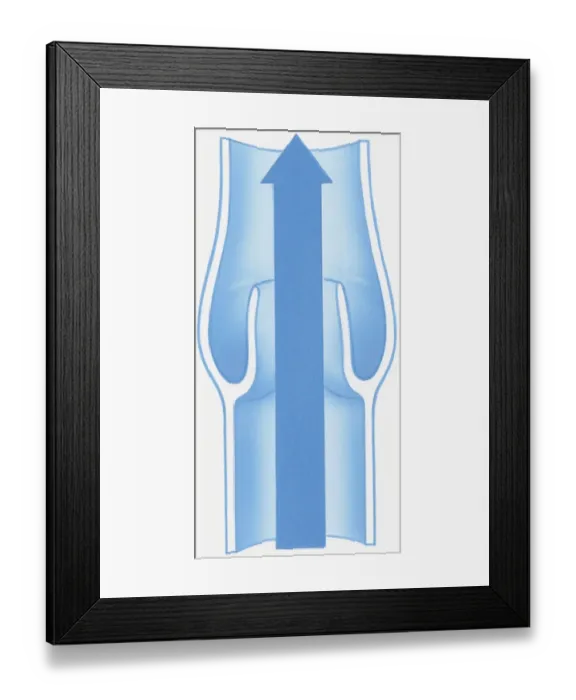 Framed Print : Illustration of open valve with arrow showing direction of blood flow Framed Print : Illustration of open valve with arrow showing direction of blood flow