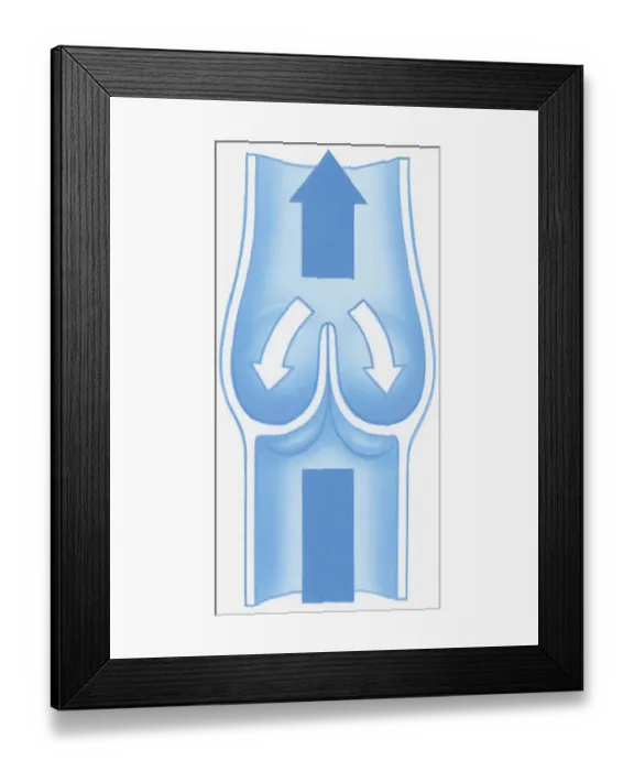 Framed Print : Illustration of shut valve stopping backward flow of blood