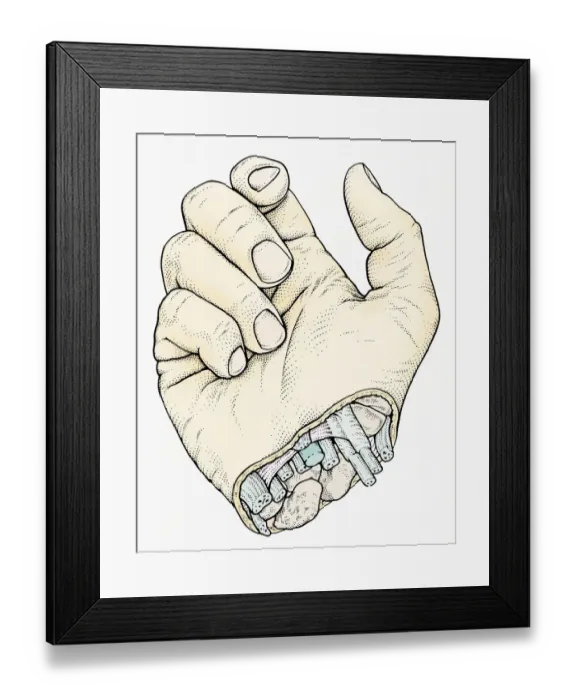 Framed Print : Illustration of human hand with cross section at wrist showing arteries, veins and nerves Framed Print : Illustration of human hand with cross section at wrist showing arteries, veins and nerves