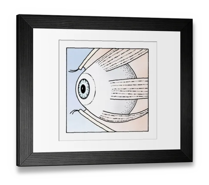 Framed Print : Illustration of abducens nerve that controls lateral rectus muscle of the human eye Framed Print : Illustration of abducens nerve that controls lateral rectus muscle of the human eye