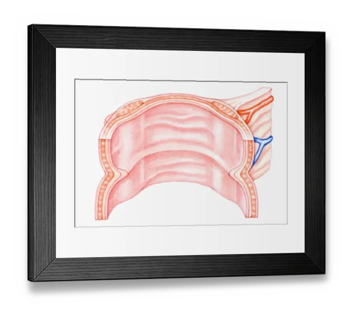 Framed Print : Cross section illustration of human large intestine Framed Print : Cross section illustration of human large intestine