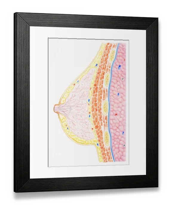 Framed Print : Breast showing rib, pectoral muscle, lung, fatty tissue, blood vessel, lobule, ampulla, nipple, areola and milk duct, cross-section Framed Print : Breast showing rib, pectoral muscle, lung, fatty tissue, blood vessel, lobule, ampulla, nipple, areola and milk duct, cross-section