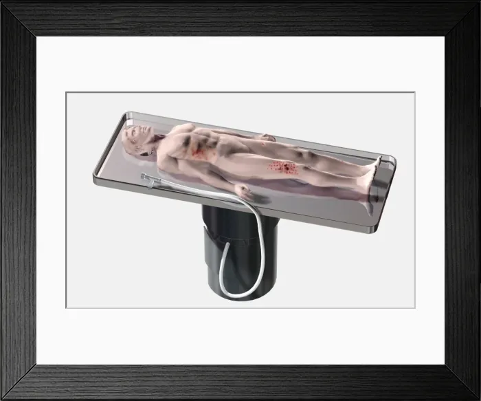 Framed Print : Model of a dead body lying on a morgue table with various injuries Framed Print : Model of a dead body lying on a morgue table with various injuries
