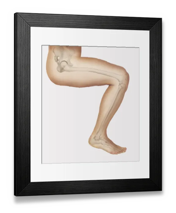 Framed Print : Diagram showing bones inside human leg, seated position Framed Print : Diagram showing bones inside human leg, seated position