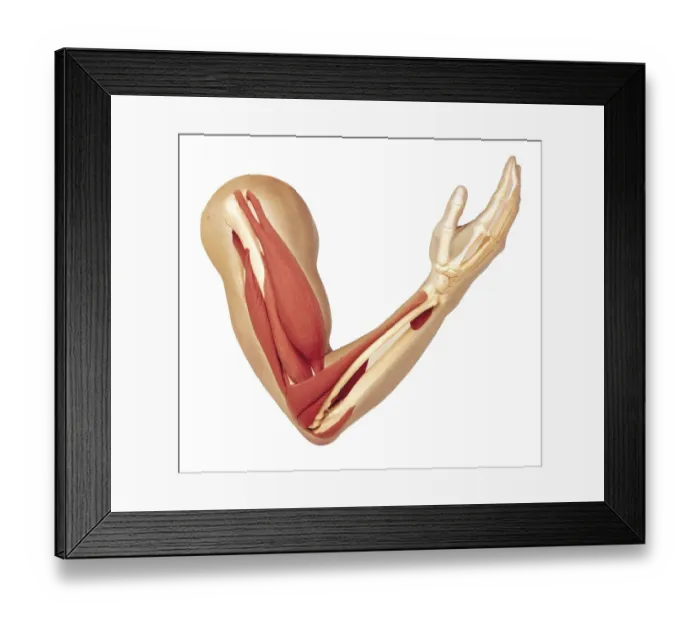 Framed Print : Human arm showing structure of muscles, triceps relaxed and stretched, bicep fully contracted to bend arm Framed Print : Human arm showing structure of muscles, triceps relaxed and stretched, bicep fully contracted to bend arm
