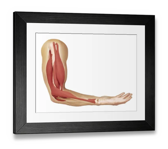 Framed Print : Human arm showing structure of muscles, biceps contracted to bend arm Framed Print : Human arm showing structure of muscles, biceps contracted to bend arm