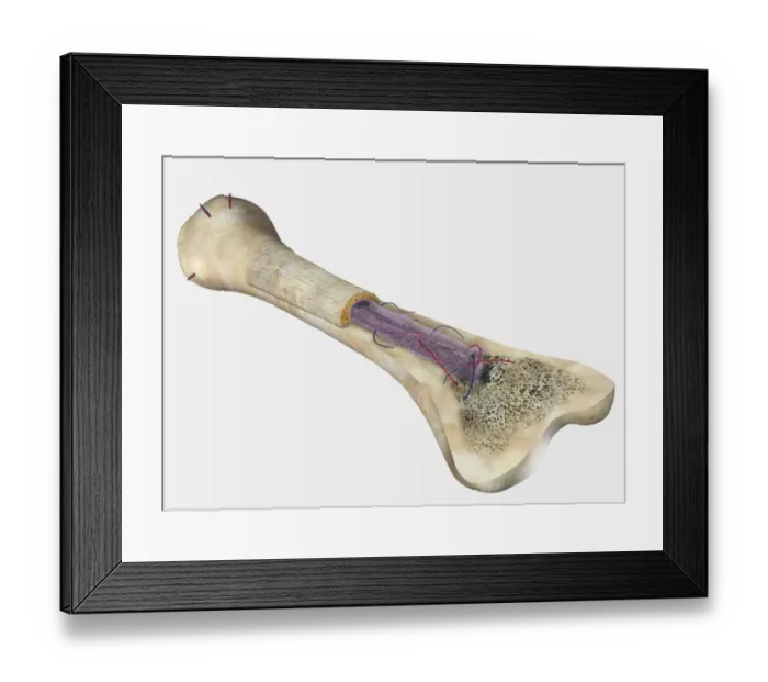 Framed Print : Human bone, cross section diagram of Femur showing osteon, veins, marrow Framed Print : Human bone, cross section diagram of Femur showing osteon, veins, marrow