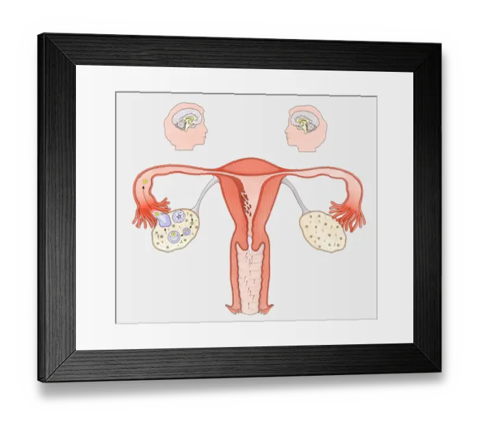 Framed Print : Diagram showing the interaction between female sexual organs and the brain, on one side, the normal reproductive cycle, and on the other, the effect of the contraceptive pill Framed Print : Diagram showing the interaction between female sexual organs and the brain, on one side, the normal reproductive cycle, and on the other, the effect of the contraceptive pill
