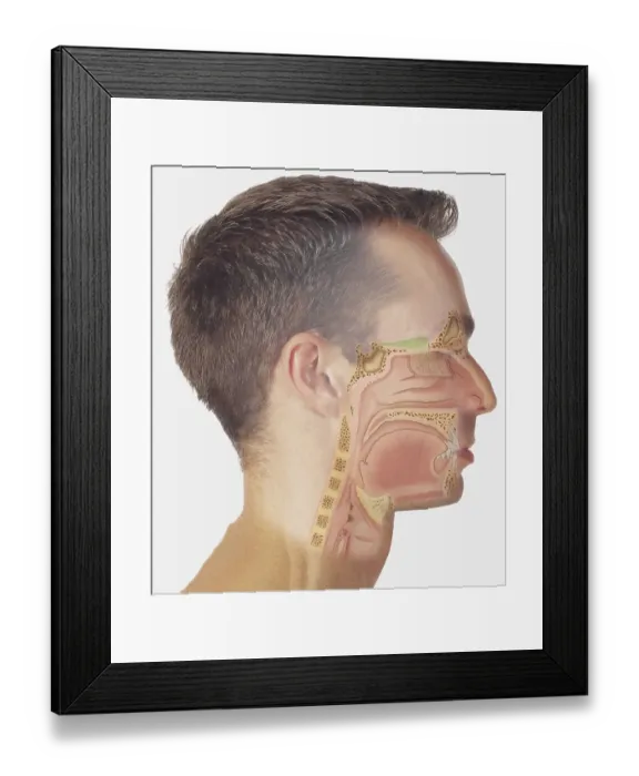 Framed Print : Diagram of nasal passages overlaid on a human head Framed Print : Diagram of nasal passages overlaid on a human head