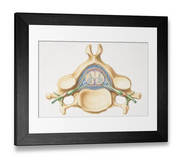 Framed Print : Anterior cross section of spinal column revealing how vertebra fits round spinal cord Framed Print : Anterior cross section of spinal column revealing how vertebra fits round spinal cord