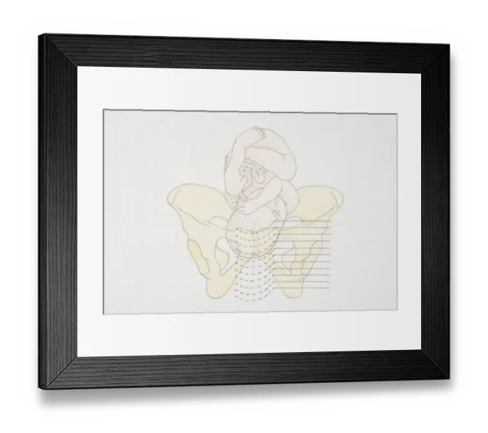 Framed Print : Diagram of womans pelvis and curled up foetus Framed Print : Diagram of womans pelvis and curled up foetus