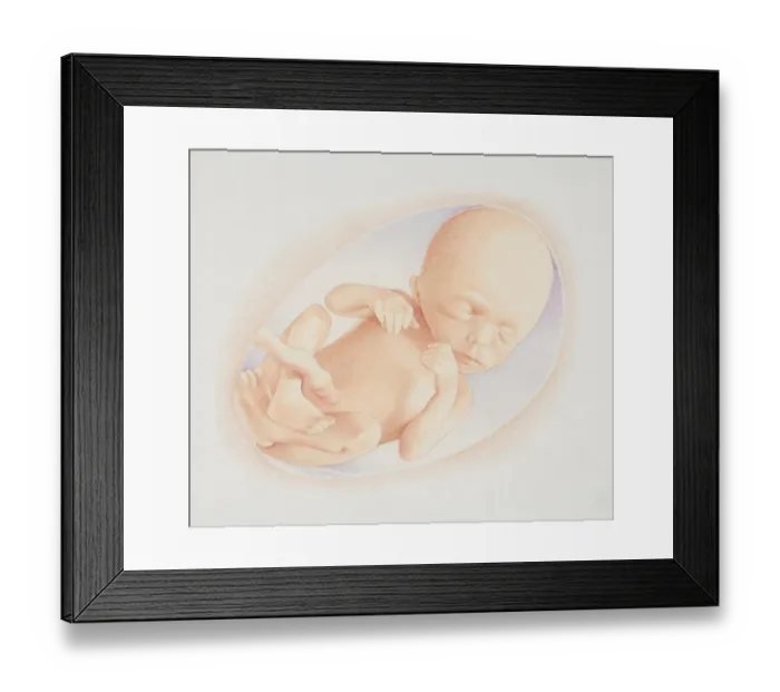 Framed Print : Foetus in the amniotic sac, front view Framed Print : Foetus in the amniotic sac, front view