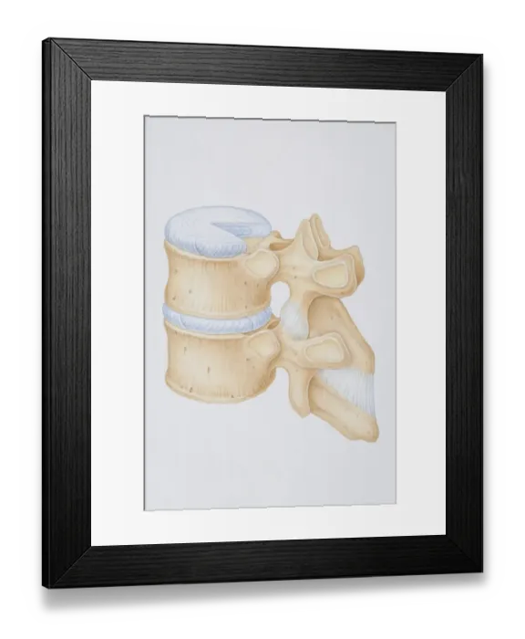 Framed Print : Diagram of a human thoracic vertebrae including the intervertebral disk, vertebral process and ligaments Framed Print : Diagram of a human thoracic vertebrae including the intervertebral disk, vertebral process and ligaments