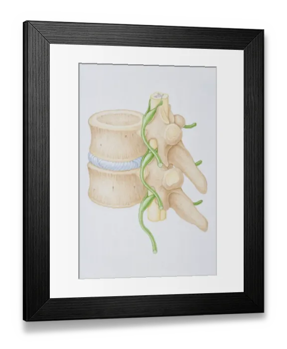 Framed Print : Section diagram depicting the human vertebral column, spinal nerve, spinal cord and vertebra of the delicate spina Framed Print : Section diagram depicting the human vertebral column, spinal nerve, spinal cord and vertebra of the delicate spina