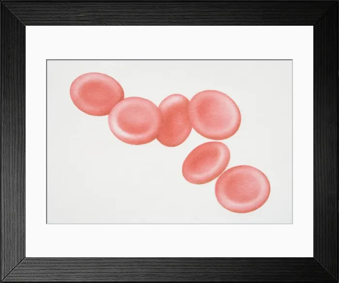 Framed Print : Six red blood cells Framed Print : Six red blood cells