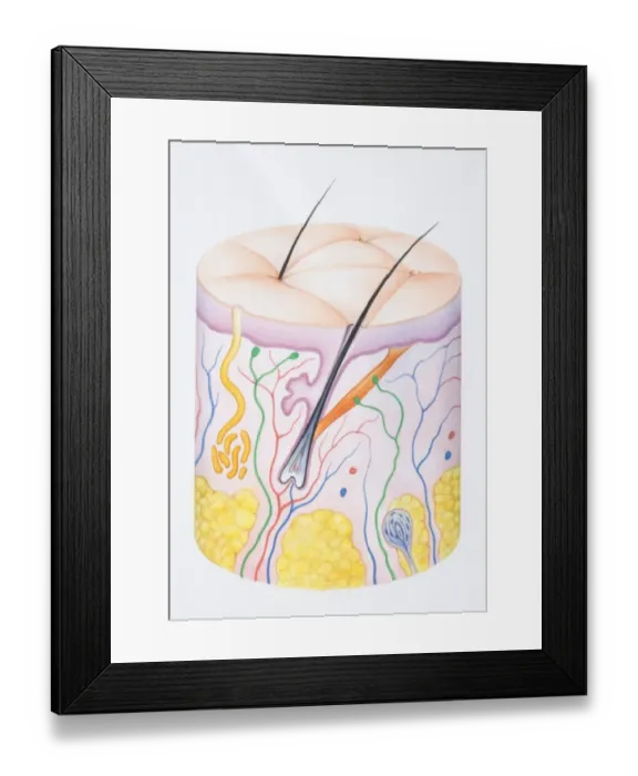 Framed Print : Diagram illustrating the two layers of human skin, epidermis, dermis and hair follicle