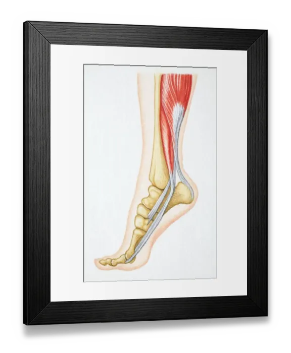 Framed Print : Foot flexed with bones and relevant muscle revealed Framed Print : Foot flexed with bones and relevant muscle revealed