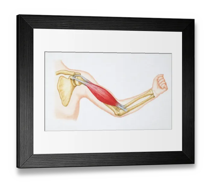 Framed Print : Arm flexing bicep with arm bones and bicep revealed Framed Print : Arm flexing bicep with arm bones and bicep revealed