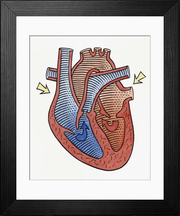 Framed Print : How the heart beats, step 2 Framed Print : How the heart beats, step 2