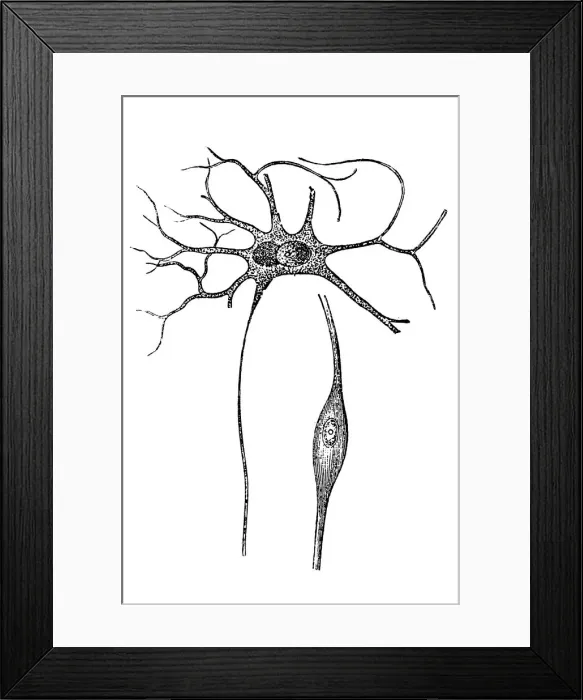 Framed Print : Ductal cells Framed Print : Ductal cells