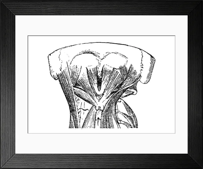Framed Print : Neck muscles