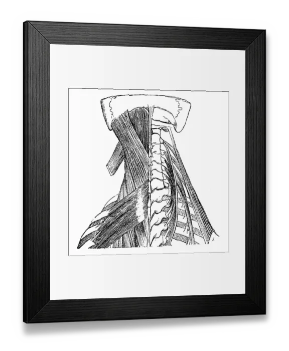 Framed Print : Neck muscles anatomy Framed Print : Neck muscles anatomy